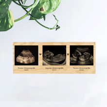 Cargar imagen en el visor de la galería, Print para colgar con ultrasonidos de bebe 
